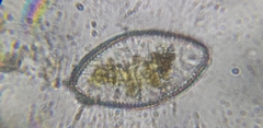 Surirella undulata