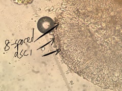 Candelariella xanthostigmoides