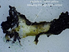 Hypogymnia incurvoides