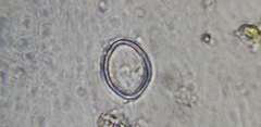 Cocconeis