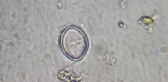 Cocconeis