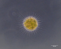 Actinosphaerium