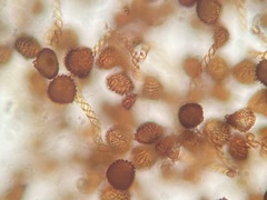 Fossombronia wondraczekii