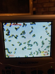 Cortinarius substriatus