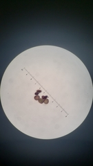 Orthotrichum papillosum