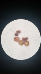Orthotrichum papillosum