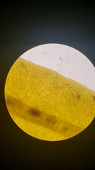 Orthotrichum papillosum