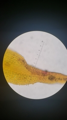 Orthotrichum papillosum