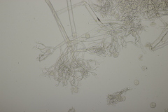 Hyaloperonospora praecox