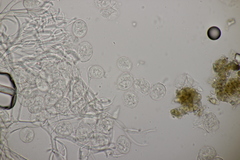 Hyaloperonospora praecox