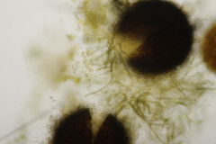 Phyllactinia corni