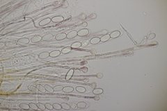 Pseudaleuria fibrillosa