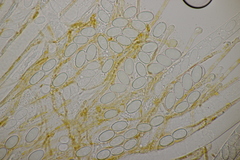 Pseudaleuria fibrillosa