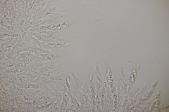 Lasionectria lecanodes