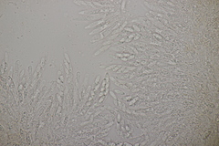 Lasionectria lecanodes