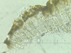 Candelariella xanthostigma