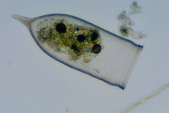 Favella