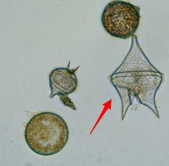 Protoperidinium