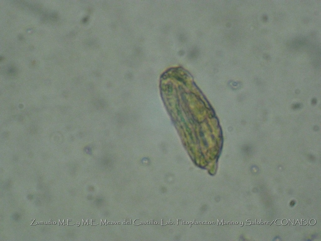 Torodinium robustum
