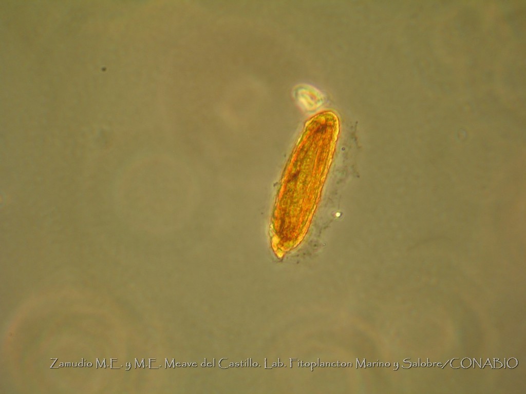 Torodinium teredo