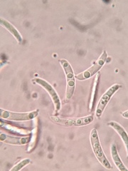 Pseudolachnea hispidula