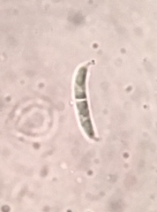 Pseudolachnea hispidula