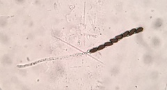 Annulohypoxylon annulatum