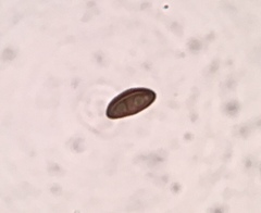 Annulohypoxylon annulatum