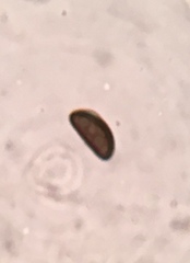 Annulohypoxylon annulatum