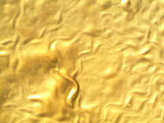 Caenorhabditis elegans