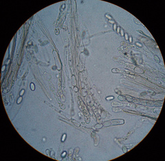Peziza ammophila
