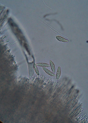 Hymenoscyphus scutula