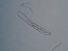 Hymenoscyphus scutula