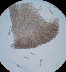 Hymenoscyphus scutula