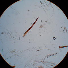 Scutellinia fujianensis