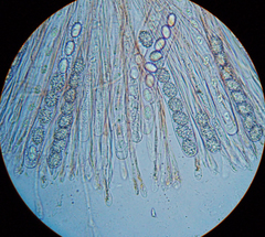 Scutellinia fujianensis