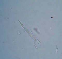 Erioscyphella abnormis