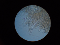 Erioscyphella abnormis