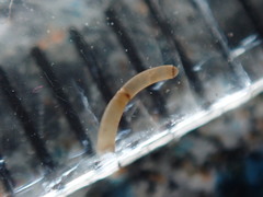 Caecum