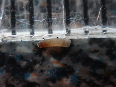 Caecum