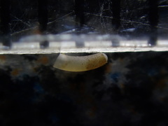 Caecum