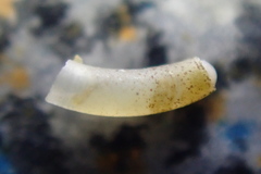 Caecum