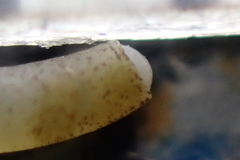 Caecum