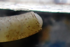 Caecum