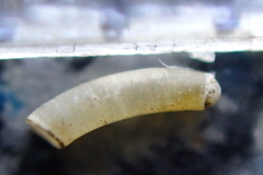 Caecum