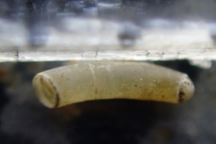 Caecum