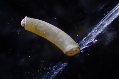 Caecum