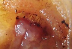 Chiloglanis bifurcus