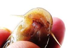 Chiloglanis bifurcus