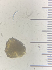 Marssonina betulae